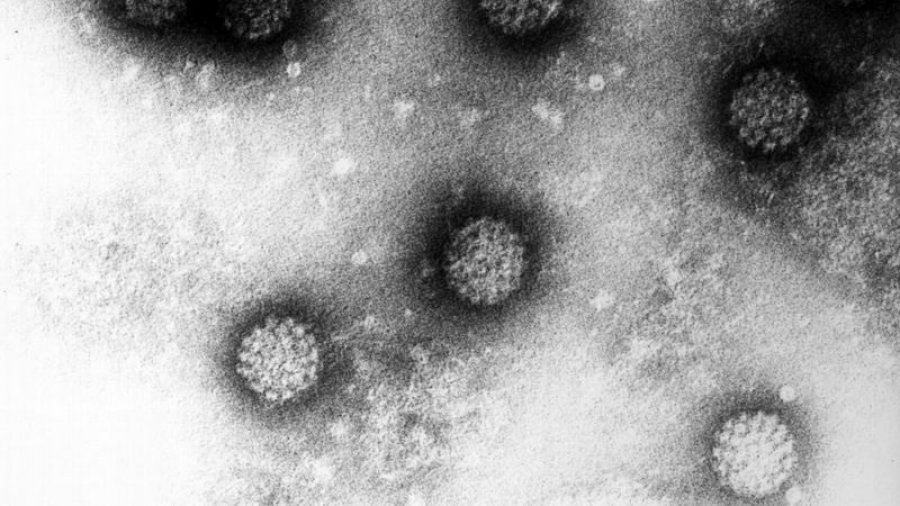 A e rrit HPV rrezikun e kancerit të qafës së mitrës?
