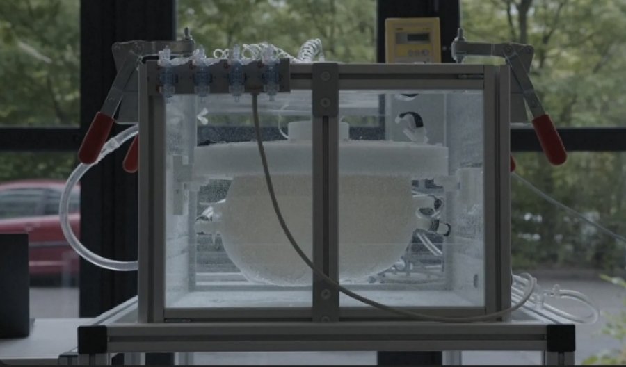 Kjo ‘mitër artificiale’ mund të shpëtojë jetën e foshnjave jashtëzakonisht të parakohshme